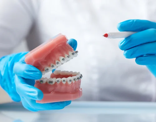 tratamiento ortodoncia Murcia